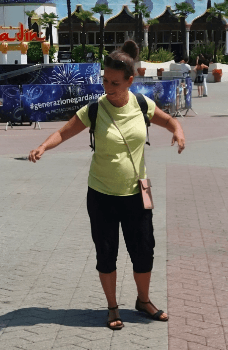 Agnieszka Ł. - przed